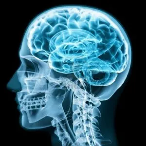 10750147-x-ray-close-up-with-brain-and-skull-concept